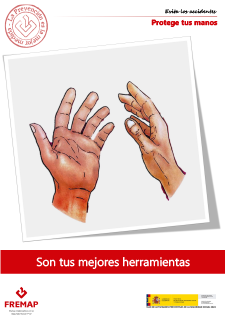 Protege tus manos